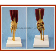 Tipo de escritorio Modelo Modelo de articulación de la rodilla humana con músculos y ligamentos